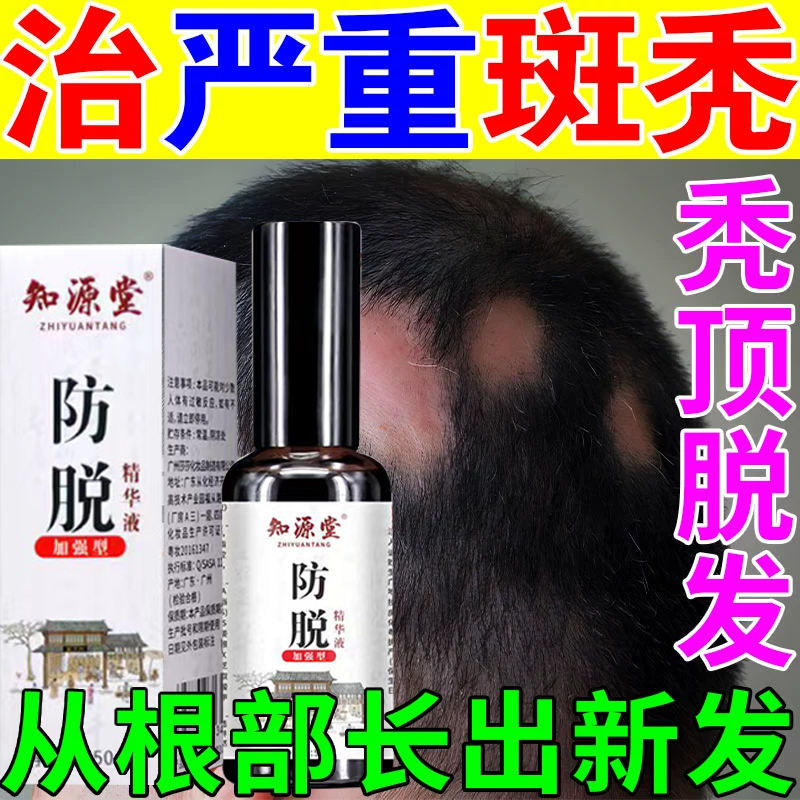 养血生发片特伶头发早白脱落滋补肝肾益气养血生发乌发