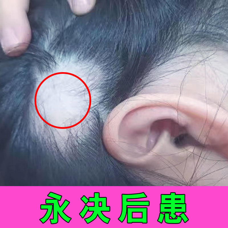 养血生发片特伶头发早白脱落滋补肝肾益气养血生发乌发