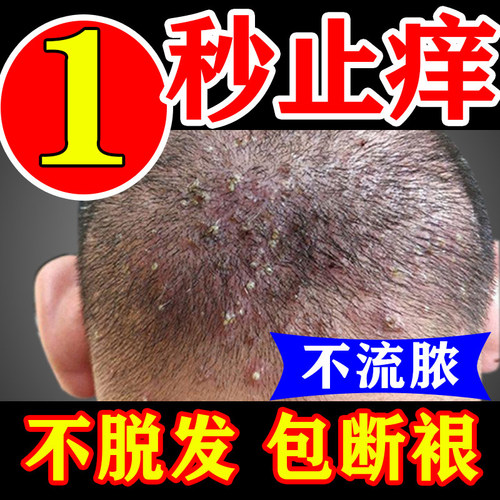 乌发胶囊美国Fakiro黑发新科技防脱发复合片维生素b6b7