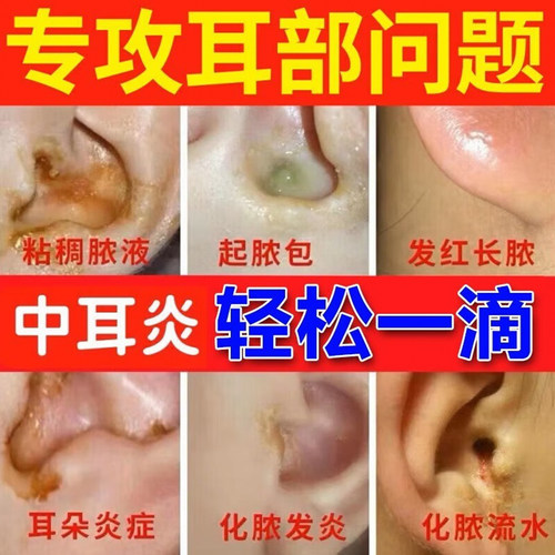 青霉素v甲片抗之峰SWP医药V钾片片