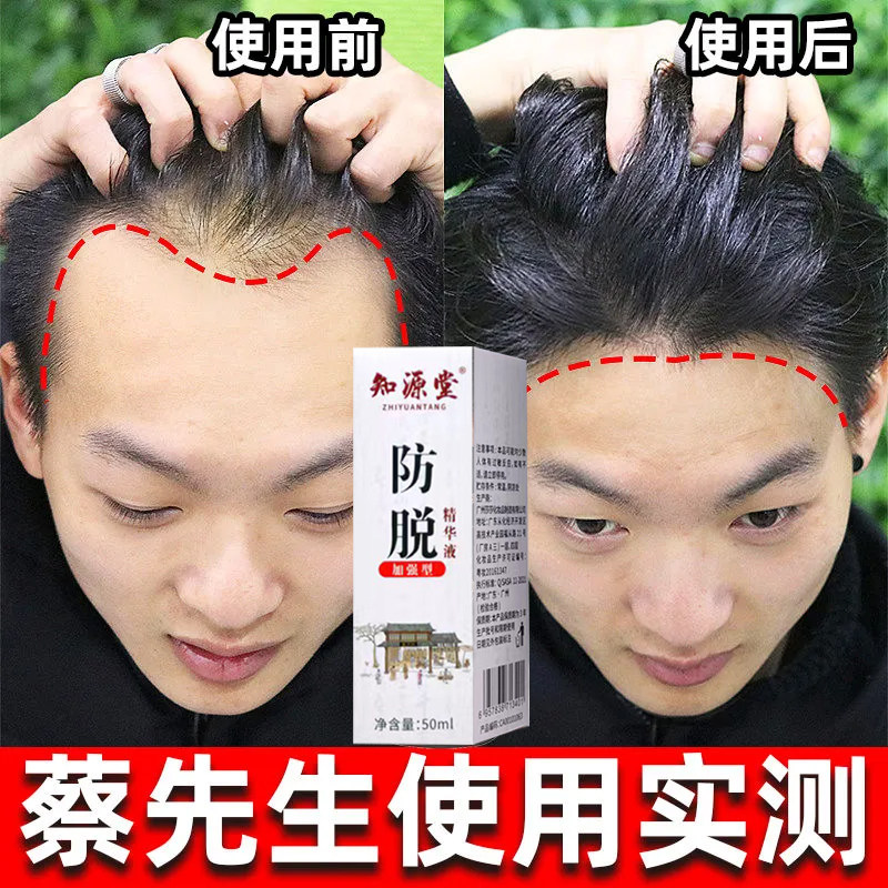 复方斯亚旦生发酊防脱发斑秃发脂溢性脱发生发增发密发中药CL