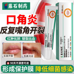 口角炎烂嘴角药膏唇炎唇膏溃疡干开裂口干燥起皮脱皮医用型儿童ZY