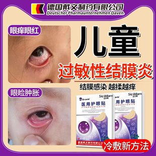 儿童过敏性结膜炎眼贴冷冰敷角膜炎眼睛痒红血丝可搭止痒眼药水ON