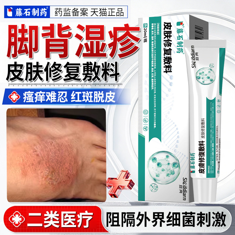 脚背湿疹真菌感染止痒外用顽固皮炎脚上水泡脱皮去瘙痒脚面癣根AW