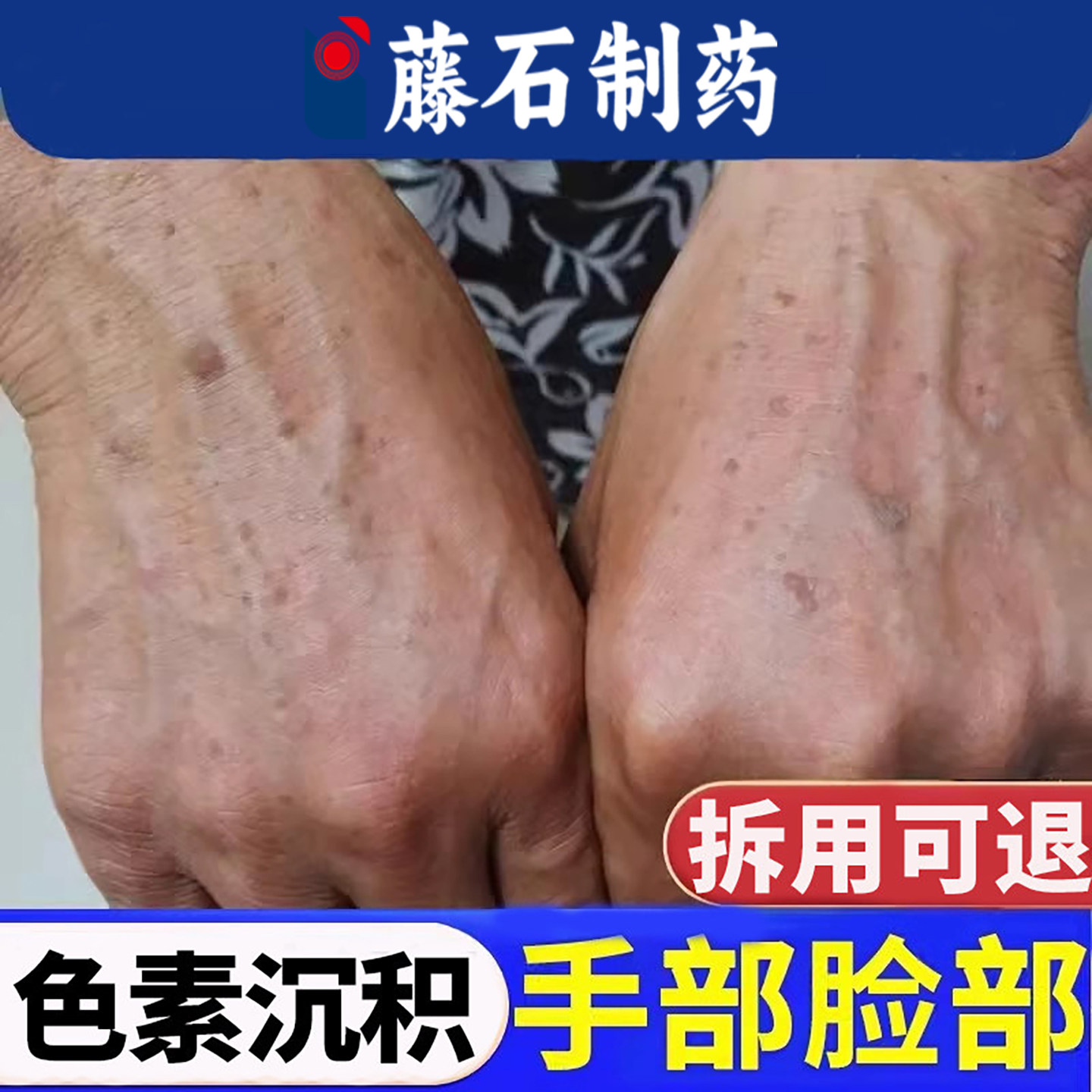 去老年斑强力可搭专用去除手背手部脸部手上旗舰店膏的一抹净YU