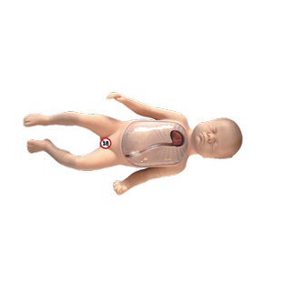 医训 YX/L67B新生儿外周中心静脉插管模型婴儿PICC置管中心静脉导管练习模拟假人