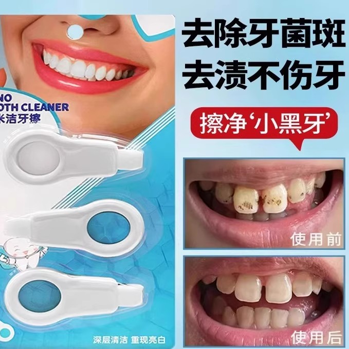 牙齿清洁牙擦去色素沉淀橡皮擦牙菌斑洗小黑牙除牙渍牙垢神器家用