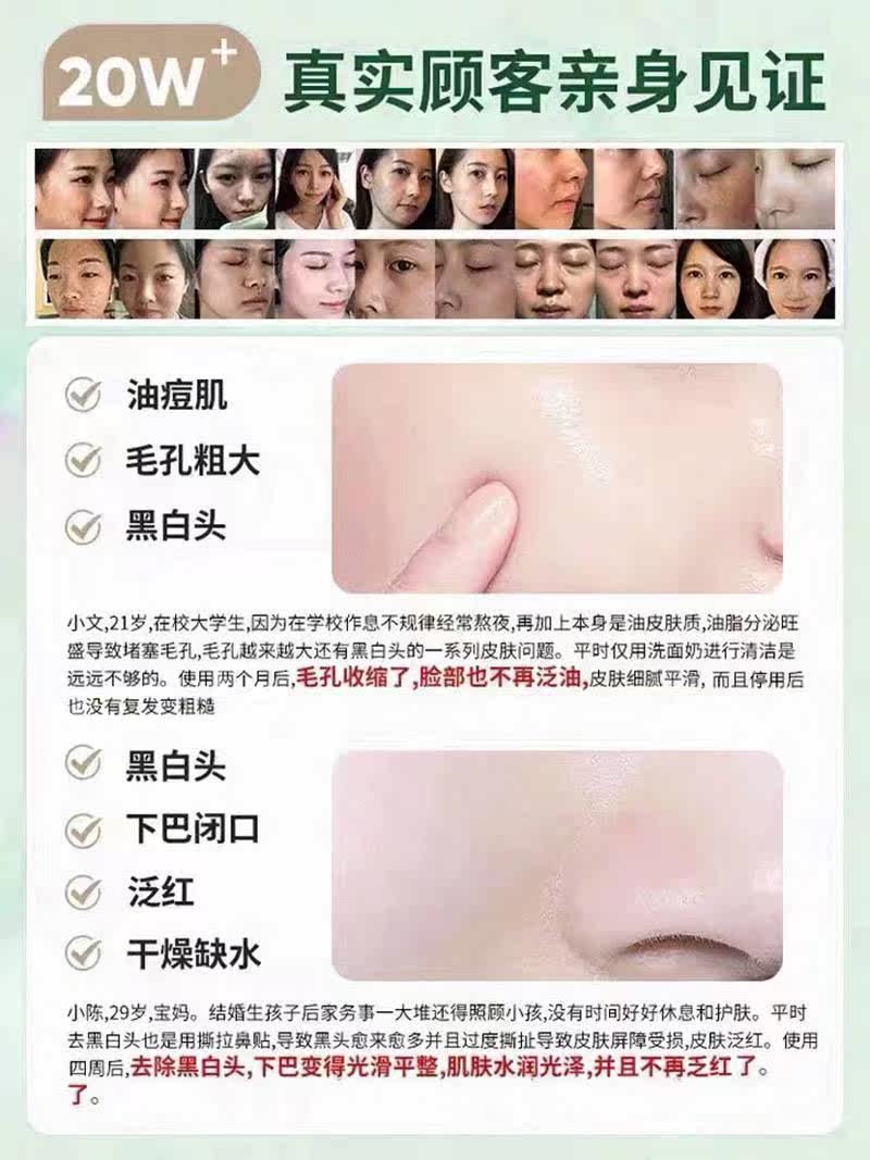 ZIB叶绿素基酸洗面奶NUH去黑控油细头嫩洁氨乳面女收缩毛孔清洁泥高性价比高么？