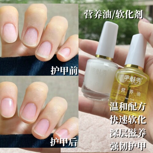 营养油预防倒刺养护指甲
