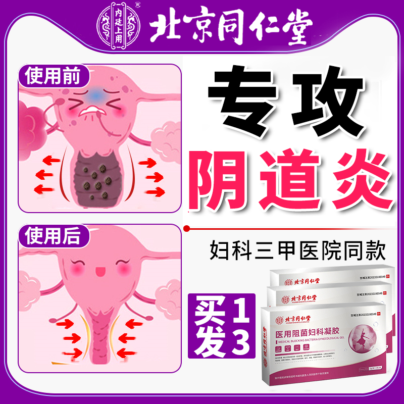 妇科凝胶正品阴道炎细菌滴虫霉菌性私处炎症抑菌异味白带多非用药