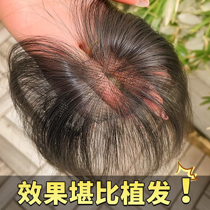 胎毛八字刘海假发女片头顶真发补发颅顶自然前额鬓角无痕发际线贴