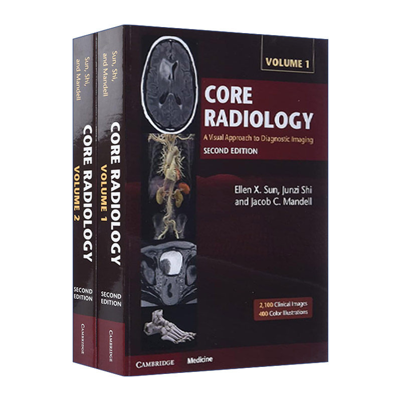 英文原版 Core Radiology 核心放射学 两册装 Ellen X. Sun 英文版 进口英语原版书籍