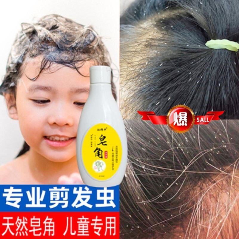 剪发虫洗发水男女儿童卷发虫吃发虫皂角液去屑止痒控油洗发露