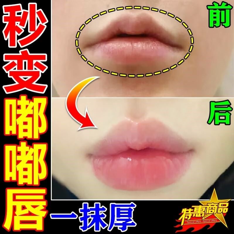 丰唇神器鱼嘴嘟嘟唇填充玻尿酸补水精华原液嘴唇变厚唇纹护理精油