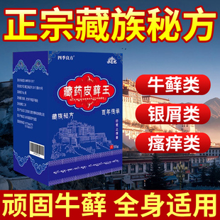藏药皮藓王牛皮药膏头皮股银去屑病皮肤杀菌症止痒抑菌正品专用癣