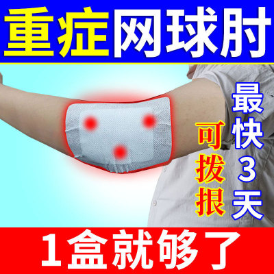 网球肘克星专用膏贴胳膊肘外侧痛