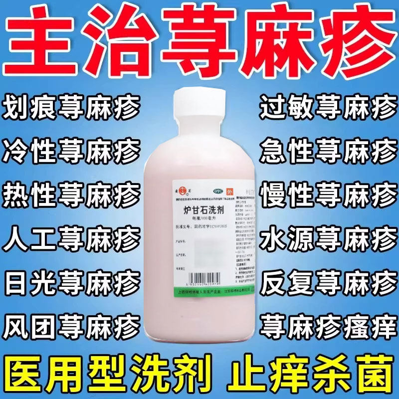 炉甘石洗剂荨麻疹湿疹皮炎丘疹过敏止痒专用抑菌皮肤瘙痒专用药QX