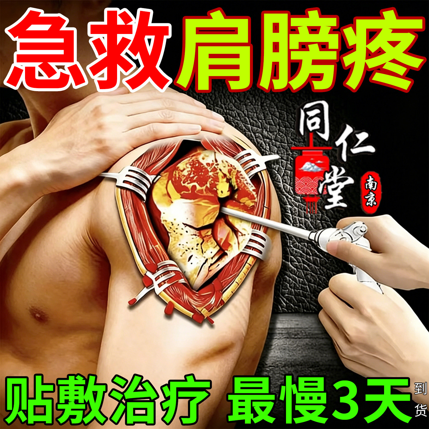 南京同仁堂肩周炎专用贴膏肩膀疼痛特膏药效贴抬臂困难五十肩热敷