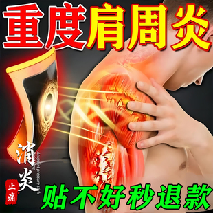 肩周炎专用治疗贴膏药特肩膀疼痛效抬臂无力肩周炎神官方旗舰店器