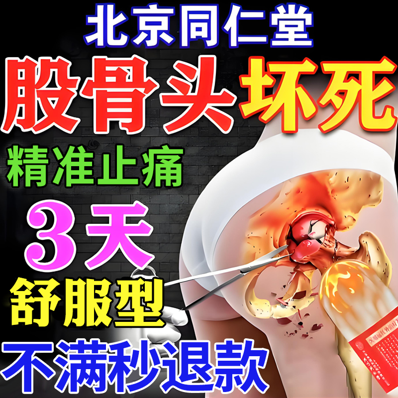 北京同仁堂股骨坏死医用治疗凝胶