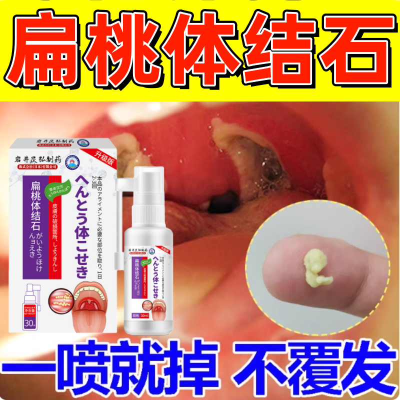 扁桃体结石去除工具喷剂漱口水清理隐窝冲洗器口腔异味口臭清洗器,洗护清洁剂/卫生巾/纸/香薰,牙刷/口腔清洁工具,淘宝优惠券,粉丝福利购,淘宝优惠卷