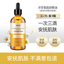洋甘菊精油面部精油脸部按摩拨筋补水保湿安抚敏感维稳肌肤美容院