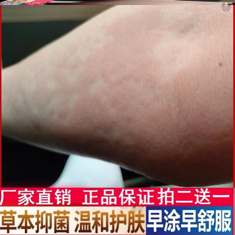 神农汉珍草皮肤抑菌膏