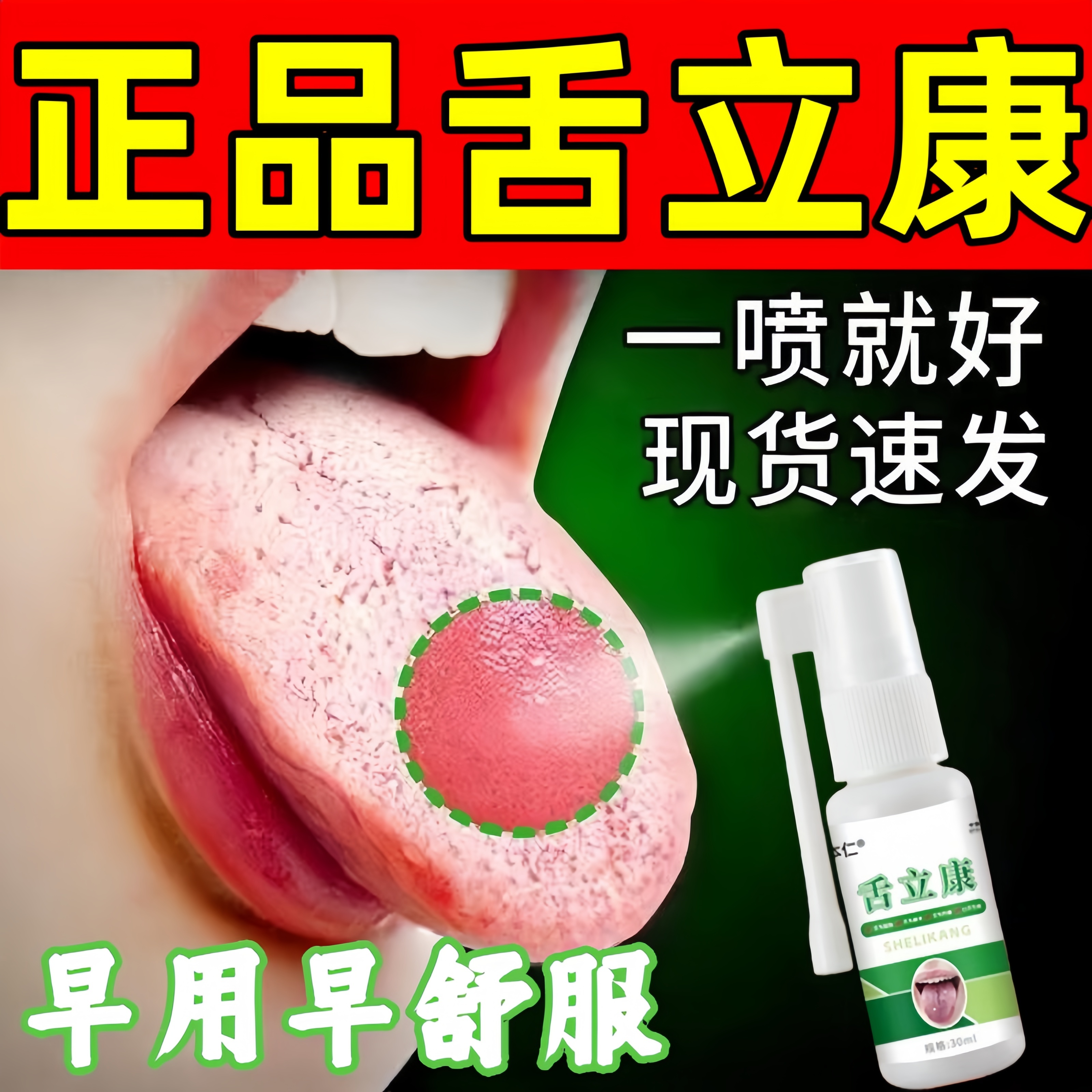 舌立康喷雾舌头裂纹有齿痕白厚口臭调理灼口综合症口干苦专用喷剂