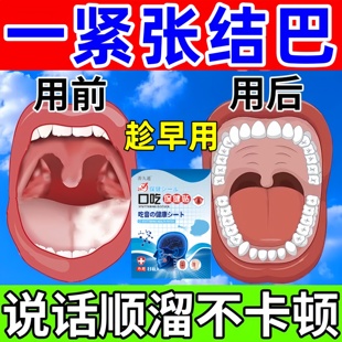 口吃结巴专用药矫正器儿童口齿不清说话大舌头紧张语言障碍贴正品