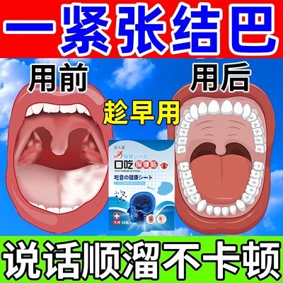 口吃结巴专用药矫正器儿童口齿不清说话大舌头紧张语言障碍贴正品