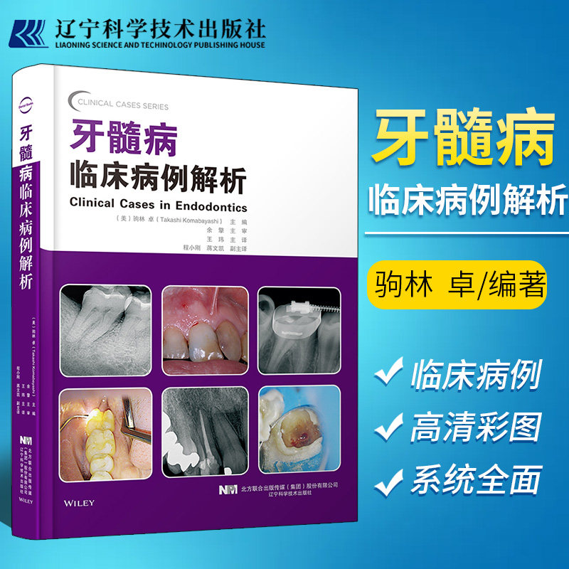 牙髓病临床病例解析 驹林卓编著 生物充填材料牙体牙髓病学牙髓病临床病例释疑牙体牙髓病学指导牙周病牙髓病牙体牙髓病学口腔医学