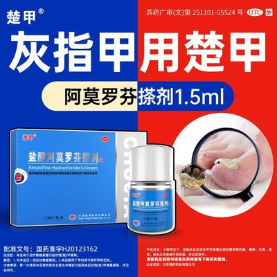 【楚甲】盐酸阿莫罗芬搽剂5%*1.5ml*1瓶/盒灰指甲甲癣真菌感染
