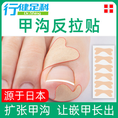 儿童夹沟专用工具嵌甲矫正器