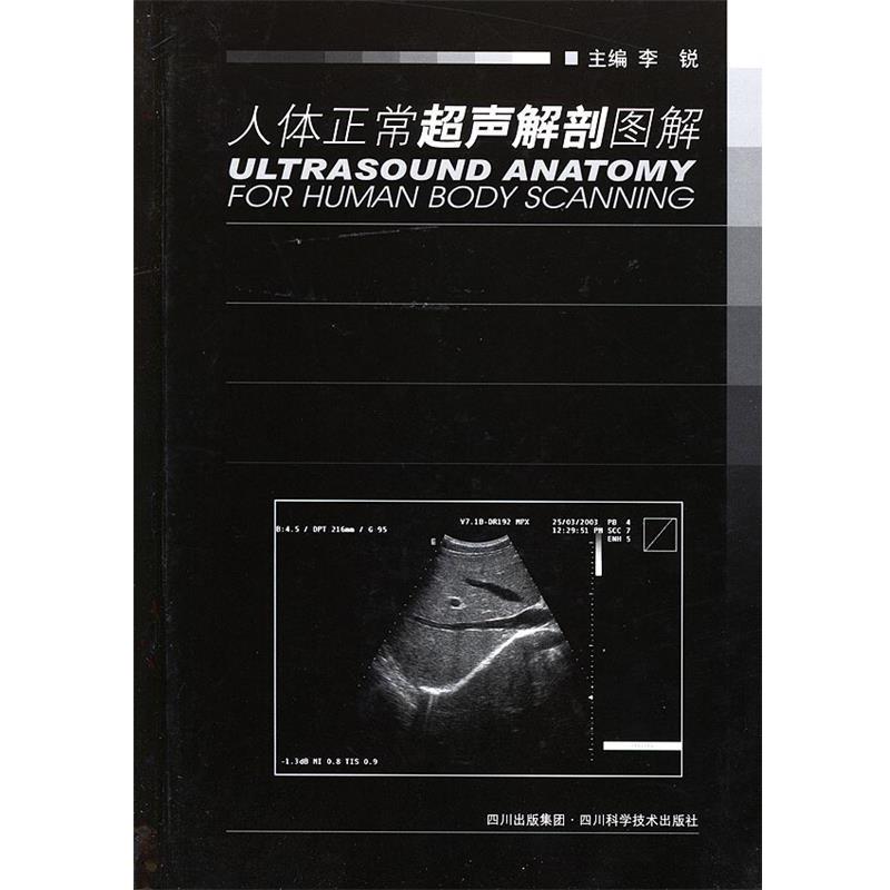 【正版书】 人体正常超声解剖图解 李锐 主编 四川科技出版社