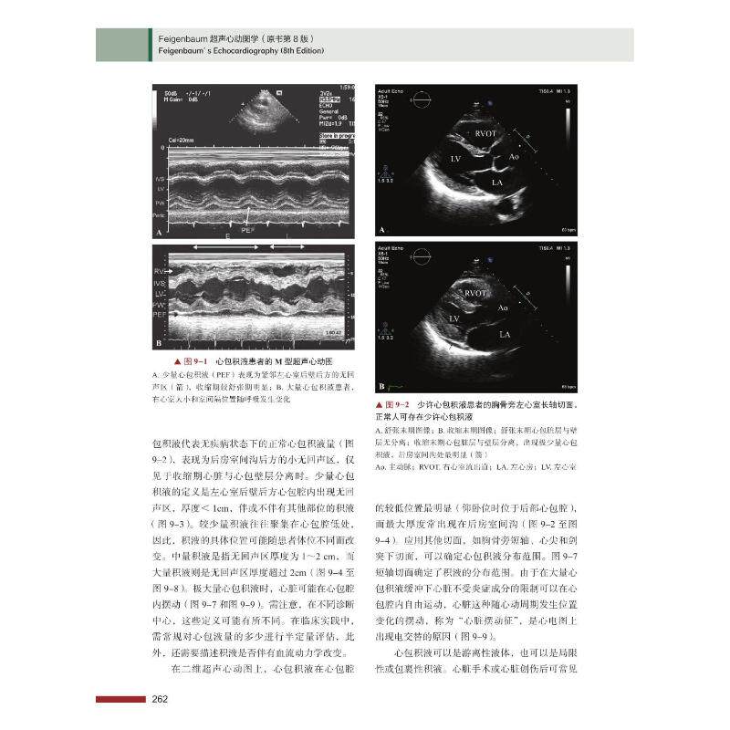 【正版新书有发票】feigenbaum超声心动图学 原书第8版