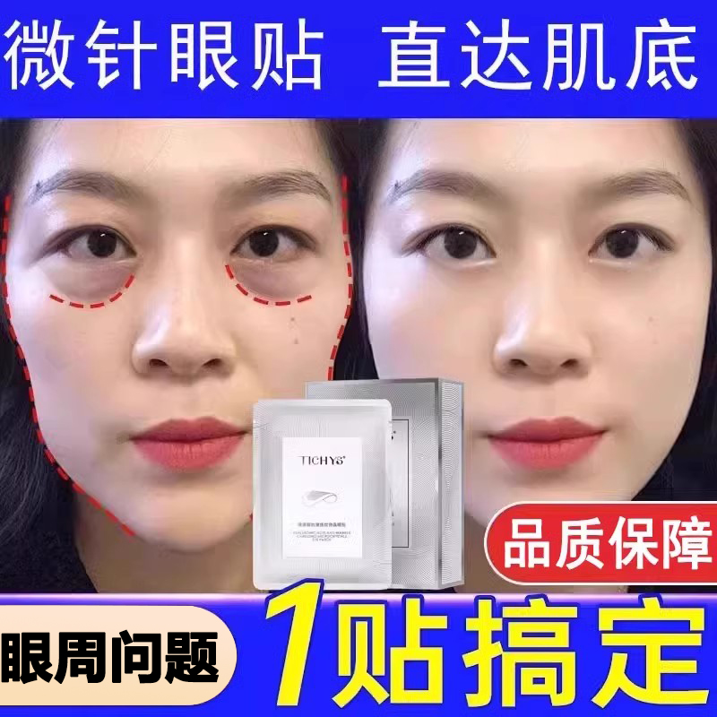 【美容院热销去黑眼圈】眼膜
