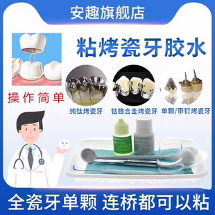 牙科自己动手粘烤瓷牙胶水牙齿钢牙套牙冠假牙专用牙科胶水粘接剂