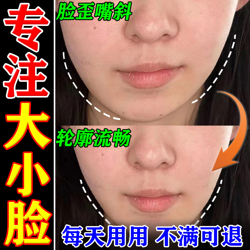 大小脸矫正神器颞下颌关节紊乱颌垫改善下巴脸歪嘴凸张口受限弹响