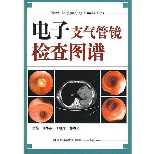 【正版】电子支气管镜检查图谱 汤华战、林均义、王晓