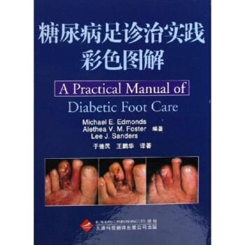 【正版书】 糖尿病足诊治实践彩色图解 [英] 埃德蒙斯,[英] 福斯特,[英] 桑德斯 著,于德民,王鹏华 译 天津科技翻译出版公司