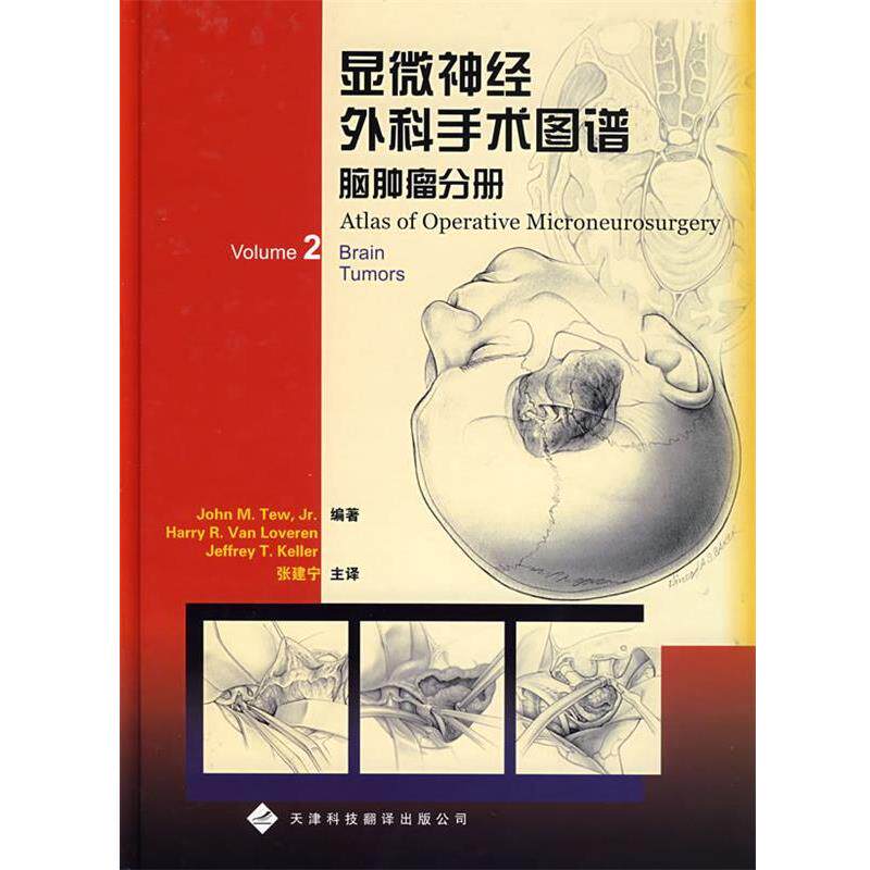 【正版书】 显微神经外科手术图谱脑肿瘤分册 (美)图(Tew,J.M) 等编著,张建宁 等译 天津科技翻译出版公司