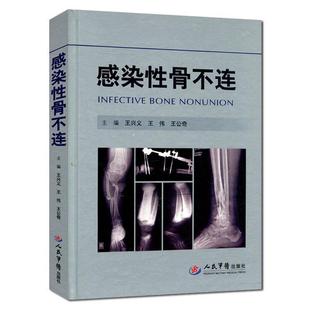 【正版书】 感染性骨不连 王兴义,王伟,王公奇 主编 人民军医出版社