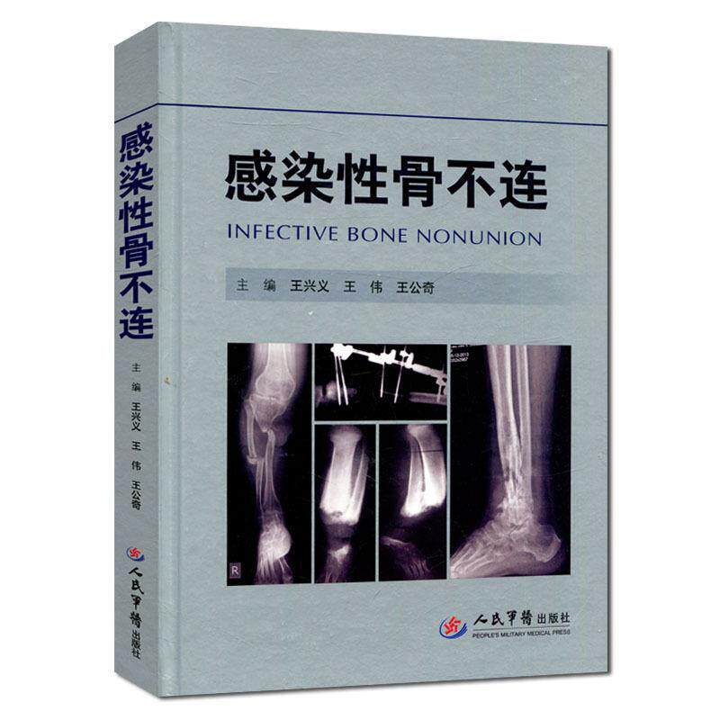 【正版书】 感染性骨不连 王兴义,王伟,王公奇 主编 人民军医出版社