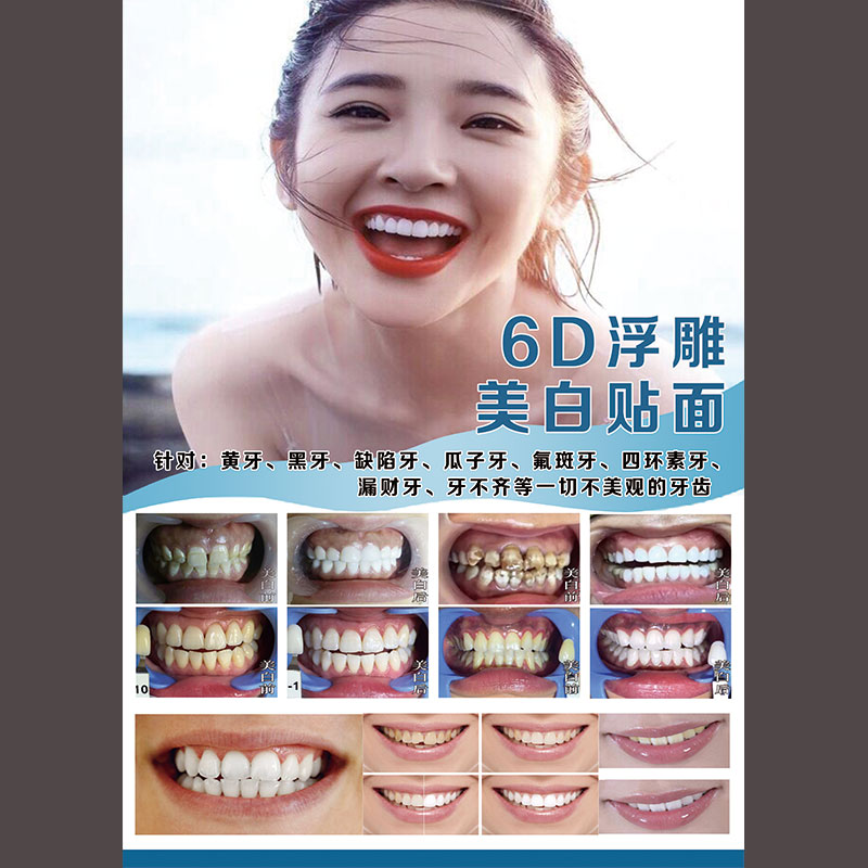 新牙图片海报6hd纳米美牙浮雕宣传画全瓷牙贴面广告冰瓷美牙墙壁