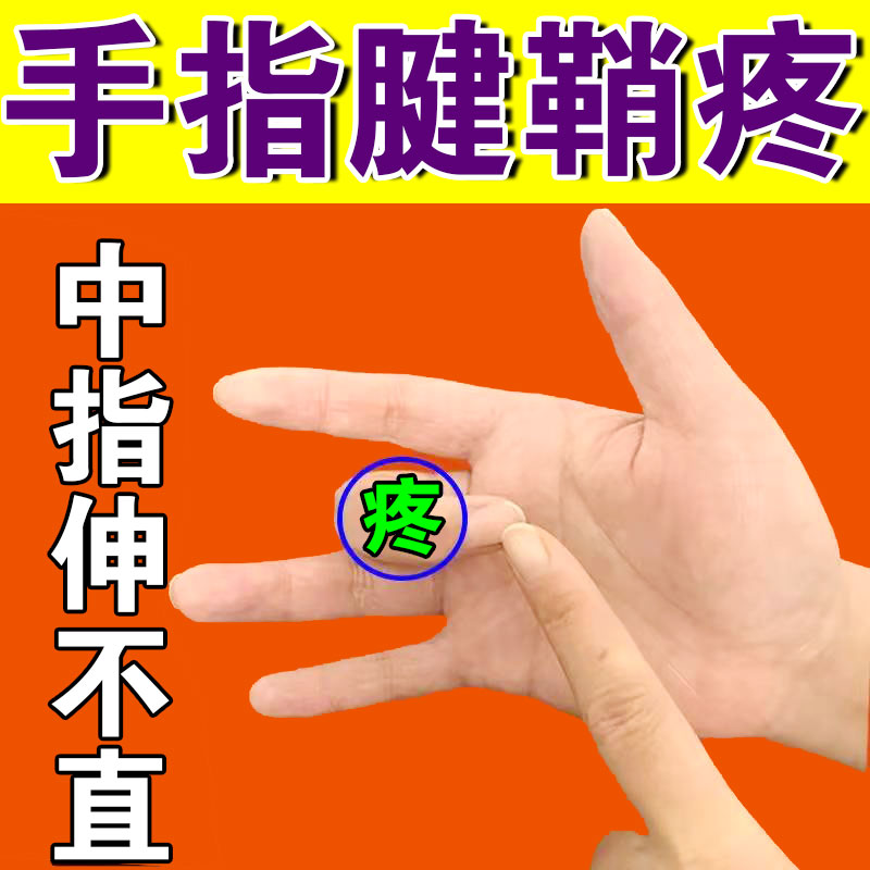 日本腱鞘炎手指狭窄压痛关节肿胀