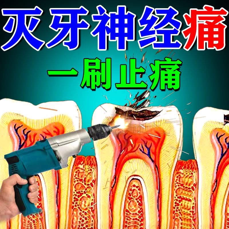 Japanese medicine for killing dental nerve to treat toothache and relieve pain effect quick tooth root inflammation and anti-inflammatory gum swelling and pain toothpaste