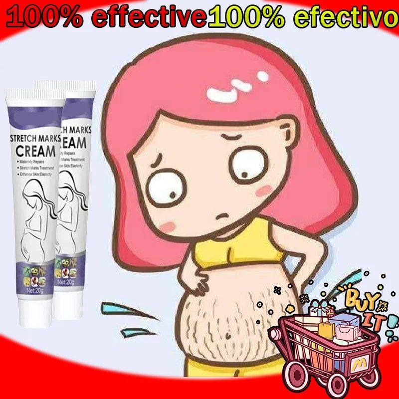 stretch marks treatment repair essential oil skin care cream