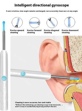 Smart Otoscope Visual ear scoop high-definition Wireless WiF