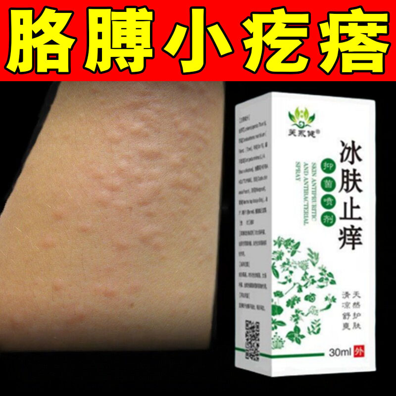 寒冷性疙瘩身上起红疙瘩膏冶皮肤皮肤消毒护理（消）