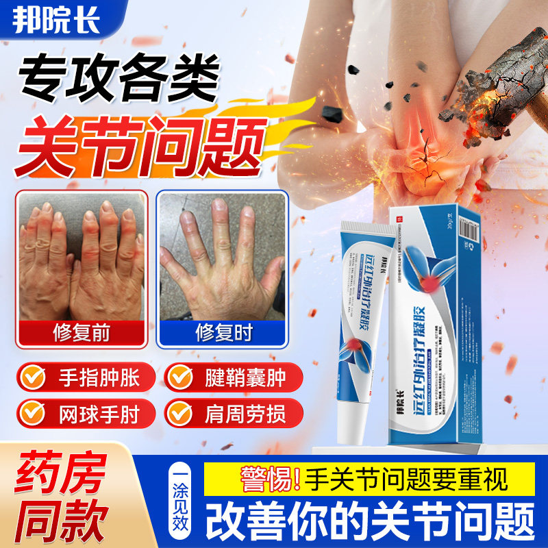 邦院长远红外治疗凝胶辅助消炎手指关节疼痛止痛胶僵硬肿胀无力